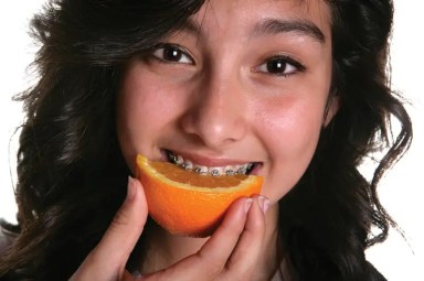 Girl-with-Braces